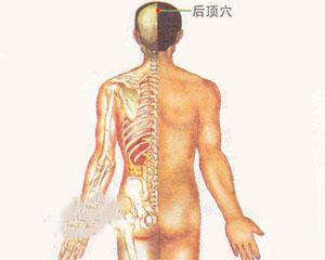 人体穴位：后顶穴