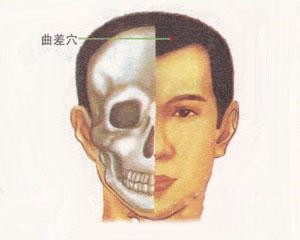 人体穴位：曲差穴