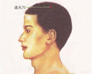 人体穴位：通天穴